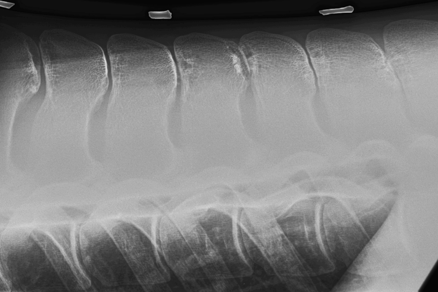Kissing spines in horses Horse Health Programme